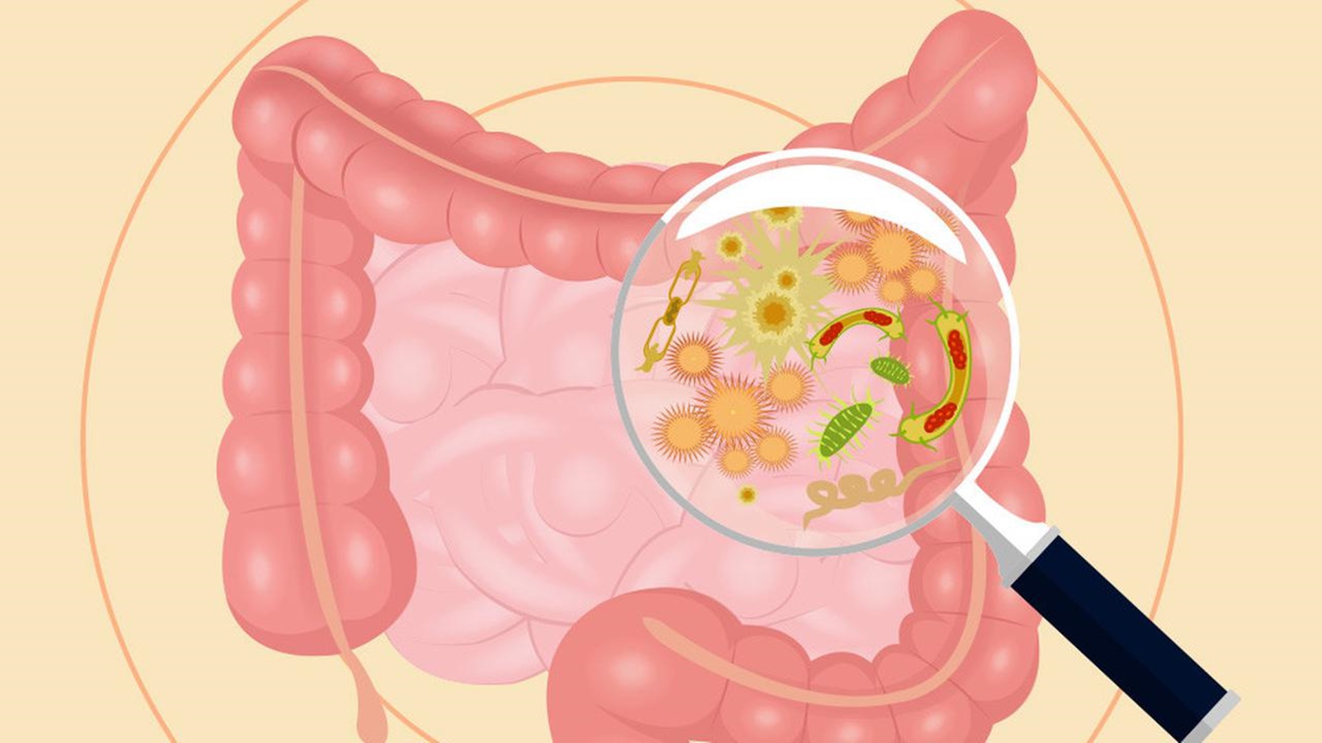 Проблемы с кишечником у ребенка. Микробиом толстой кишки. Микробиота толстой кишки. Микрофлора Толстого кишечника картинки.